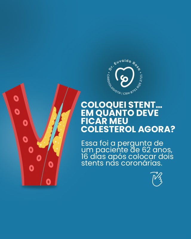 Colocou stent? O cuidado não acaba ali. É só o começo de uma nova fase de atenção com a sua saúde ❤️

#cardiologia #colesterol #saudedocoracao #prevencao #qualidadedevida