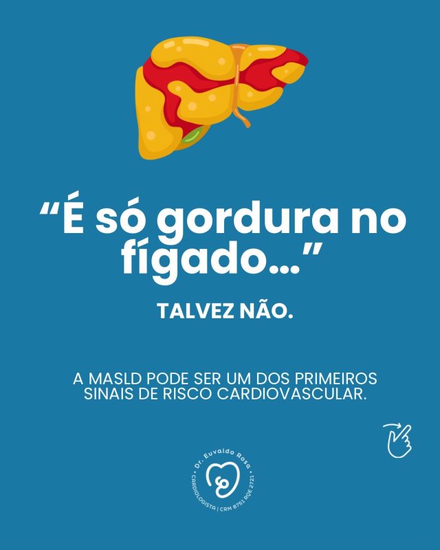 “Muita gente ainda acredita que fígado gorduroso é algo simples.
Mas a MASLD pode ser um importante marcador de risco cardiovascular e metabólico.

O problema é que ela costuma ser silenciosa… e descoberta apenas quando o organismo já está em desequilíbrio.

O fígado pode estar dando sinais que o coração sentirá no futuro.”

#MASLD #EsteatoseHepatica #SaudeCardiovascular #Cardiologia #DrEuvaldoRosa