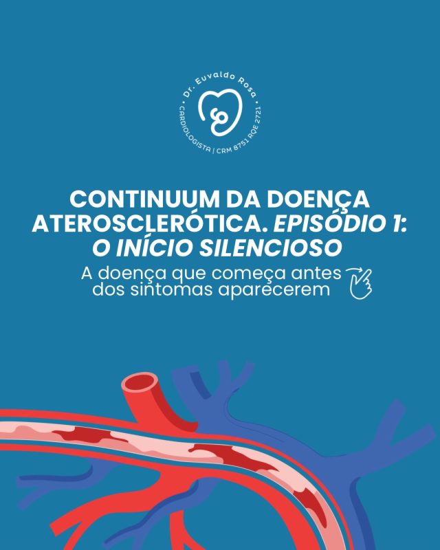 A aterosclerose não começa no infarto. Ela começa muito antes, de forma silenciosa, enquanto a vida segue normalmente.

Entender esse processo é o primeiro passo para prevenir as doenças cardiovasculares e cuidar da sua saúde antes que os sintomas apareçam.

Deslize o carrossel e descubra como tudo começa. ❤️

#Cardiologia #SaúdeDoCoração #Prevenção #QualidadeDeVida #Saúde